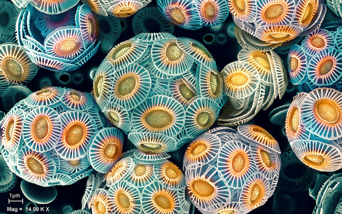 Winners of ZEISS Microscopy Image Contest Announced